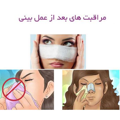 مراقبت های بعد از جراحی بینی - دکتر یزدانی