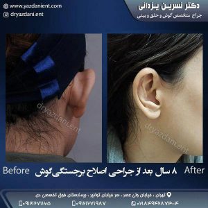 جراحی زیبایی گوش - دکتر نسرین یزدانی