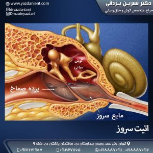 اتیت سروز- دکتر یزدانی