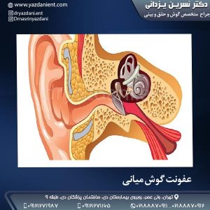 عفونت گوش میانی - دکتر نسرین یزدانی