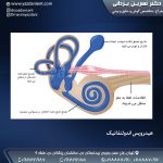 هیدروپس اندولنفاتیک + علائم و راه های درمان + دکتر یزدانی