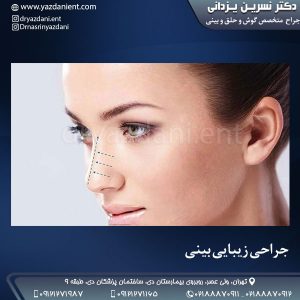 جراحی زیبایی بینی- دکتر یزدانی
