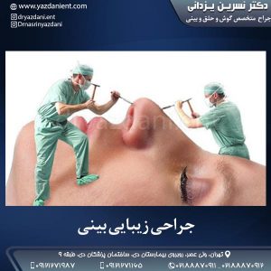 جراحی زیبایی بینی- دکتر یزدانی