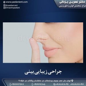جراحی زیبایی بینی- دکتر یزدانی