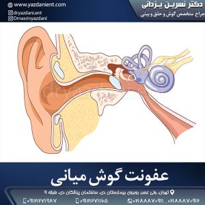 عفونت گوش میانی - دکتر یزدانی