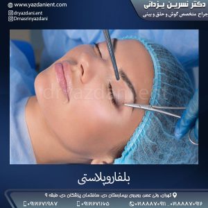 بلفاروپلاستی- دکتر یزدانی 