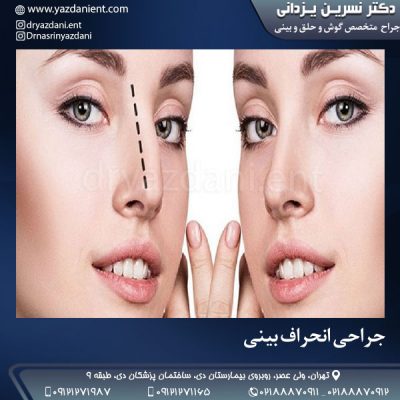 جراحی انحراف بینی - دکتر یزدانی