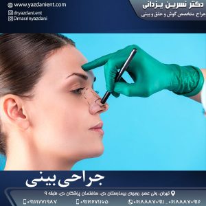 جراحی بینی- دکتر نسرین یزدانی