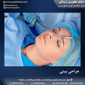 جراحی بینی- دکتر نسرین یزدانی