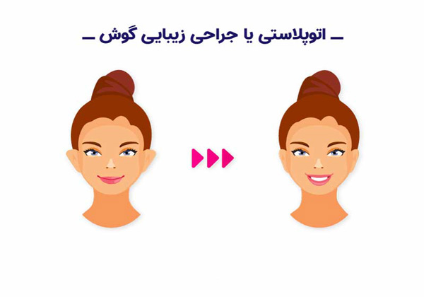 جراحی گوش - دکتر یزدانی