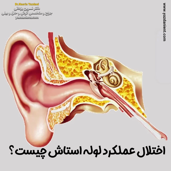 شیپور استاش - دکتر نسرین یزدانی