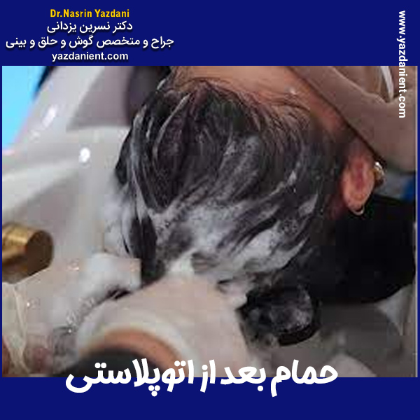 حمام بعد از اتوپلاستی - دکتر نسرین یزدانی