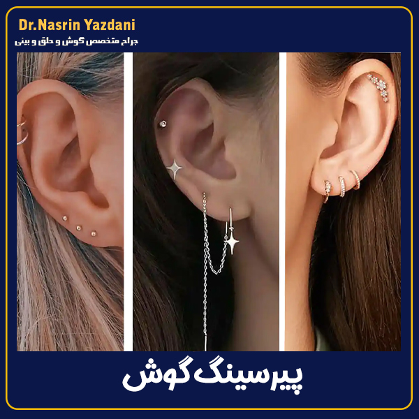 پیرسینگ گوش - دکتر نسرین یزدانی