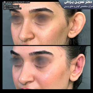 جراحی گوش -دکتر نسرین یزدانی