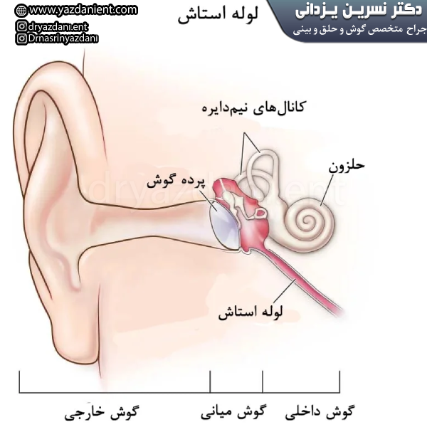 چسبندگی پرده گوش - دکتر نسرین یزدانی