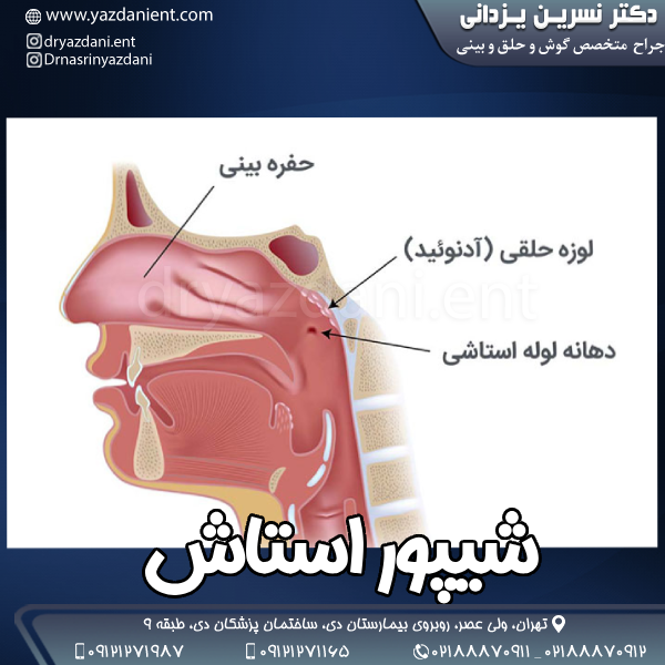 شیپور استاش - دکتر نسرین یزدانی