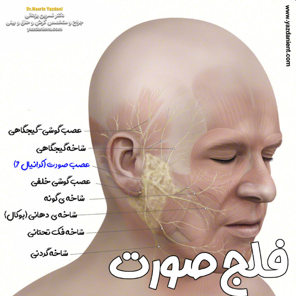 فلج صورت با دکتر نسرین یزدانی بهترین جراح گوش تهران